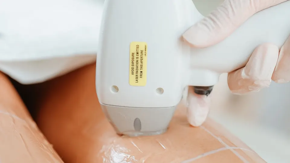 Imagen de muestra: depilación con luz en las piernas
